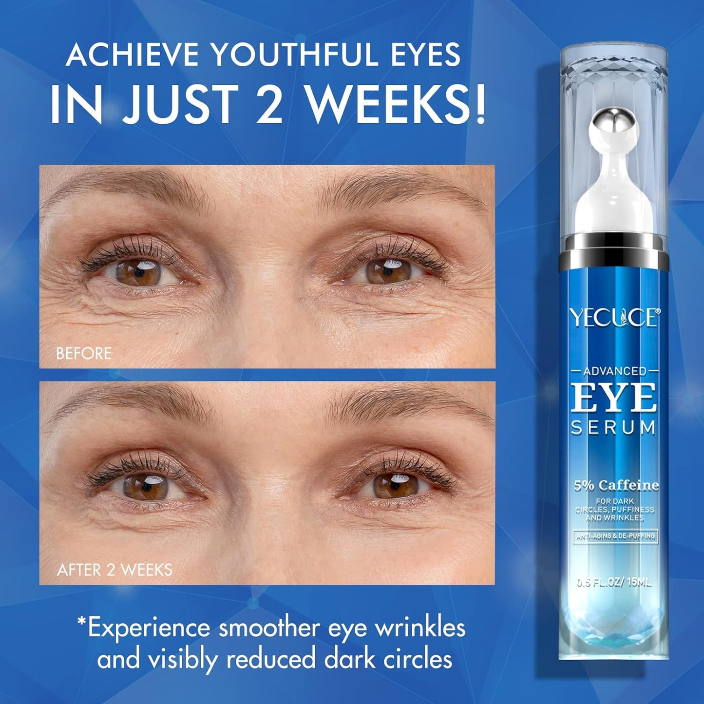 Eye Serum for Dark Circles