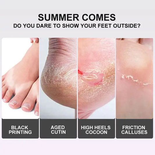 Foot Exfoliation Peeling Mask (Levender)