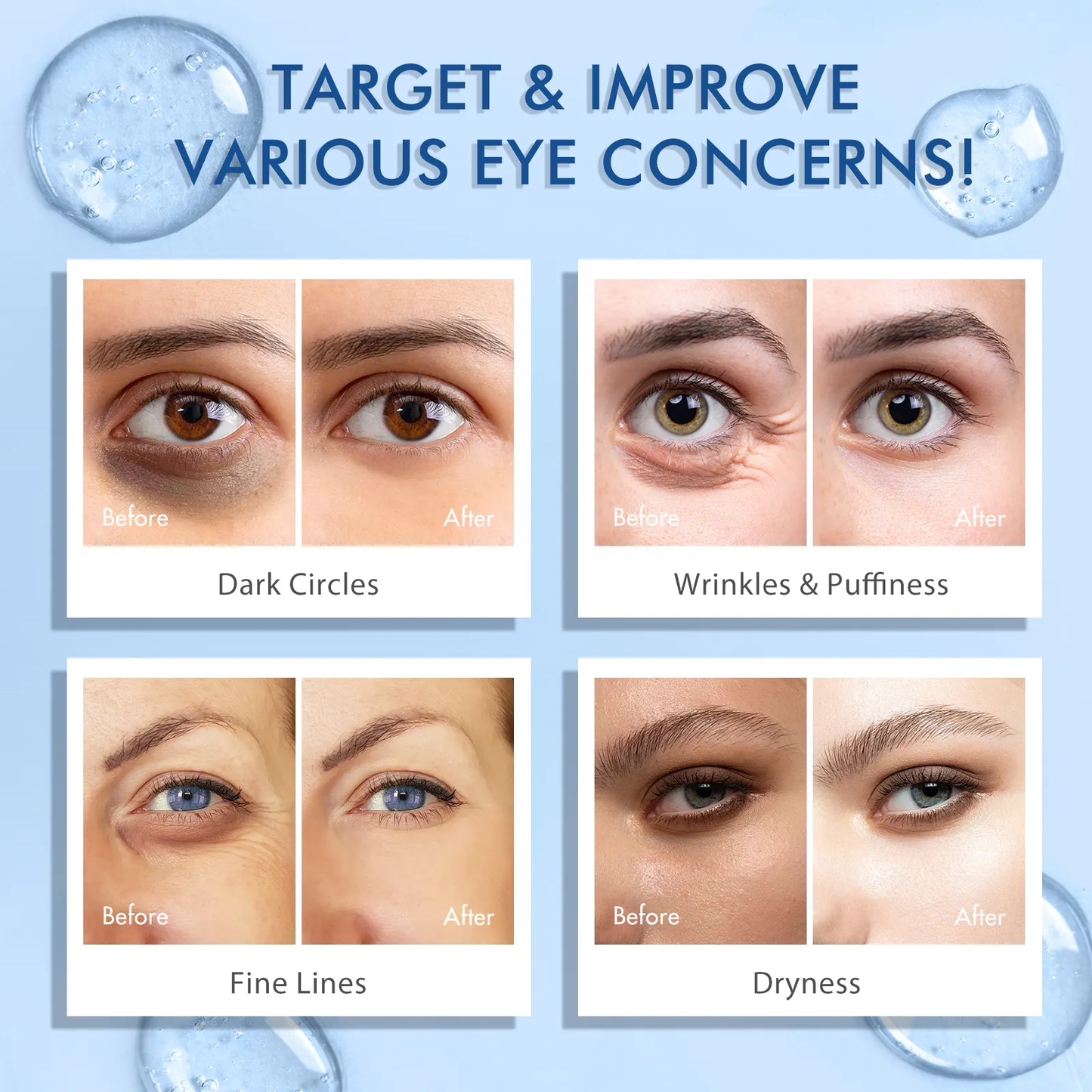 Eye Serum for Dark Circles